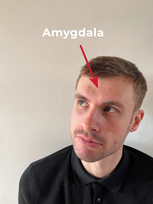 Callum looking up into midair. There is an arrow pointing to the part of his brain where the Amygdala is located. The text "Amygdala" is next to the arrow.