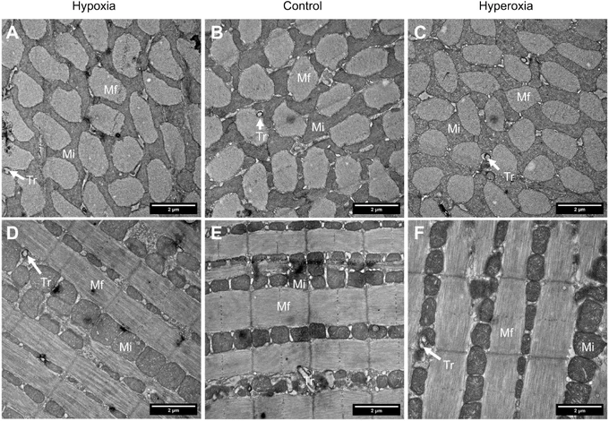 TEM of M. sexta flight muscle showing no major difference between moths raised in hypoxic, control or hyperoxic conditions.
