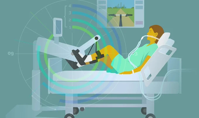 Illustration of a mechanically ventilated patient cycling in a hospital bed.