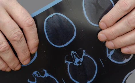 a photo of a brainscan with multiple images.