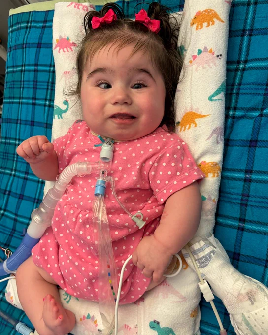 Infant with a joyful expression, wearing a pink polka dot outfit and colorful hair bows, reclining on a blanket with dinosaur patterns. The child is equipped with medical tubes and devices.