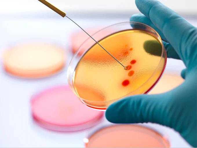 A close-up image of a gloved hand holding a petri dish containing a yellow growth medium with red bacterial colonies. A lab tool is being used to transfer or sample the colonies, indicating a laboratory setting focused on microbiological or biomedical research.