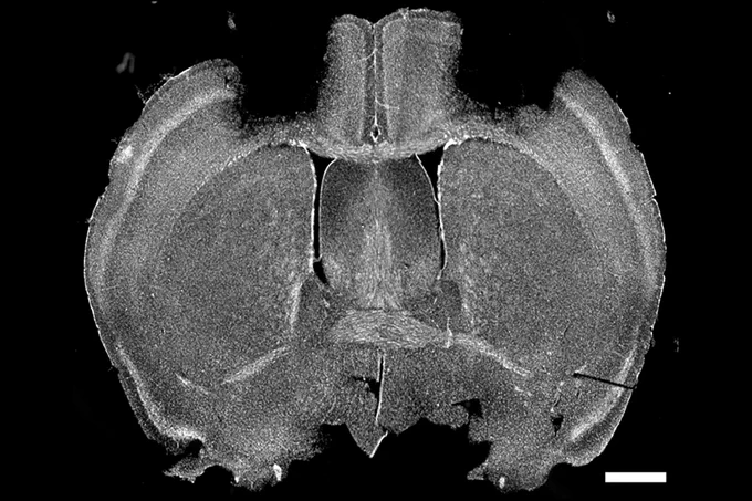 A cross section rat brain with the primary motor cortex removed.