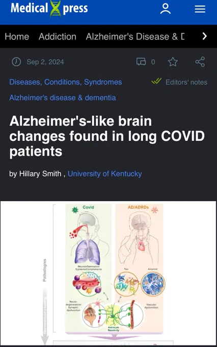 Screenshot from a article headline from MedicalXpress reading “Alzheimer’s-like brain changes found in long Covid patients”

Date: September 2, 2024