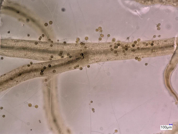 microscopy image of plant roots interacting with arbuscular mycorrhizal fungi