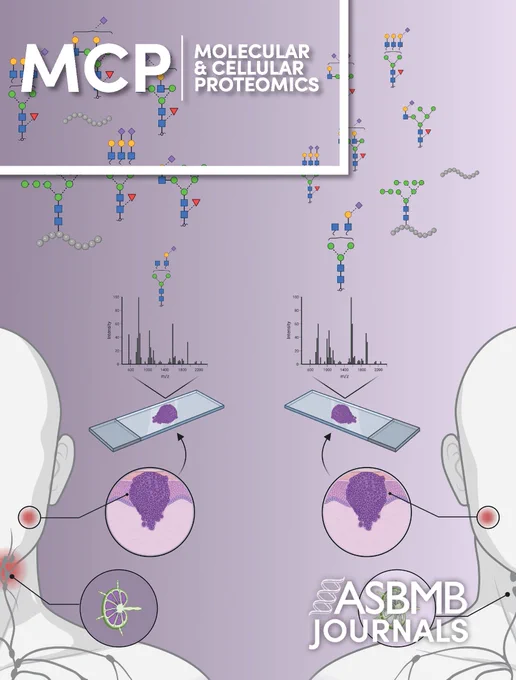 Powered by a comprehensive glycomics-assisted glycoproteomics approach, we provide new insights into the heterogenous N-glycoproteome in oral cancer from patients with and without lymph node metastasis. The study uncovers glycosylation features that are linked to patient survival and form a resource to further explore the underpinning disease mechanisms and uncover new prognostic glyco-markers for oral cancer.