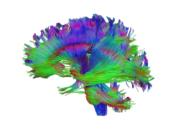 3D modelling image of the nerve tracts in a healthy brain from the side in blue, purple and green.