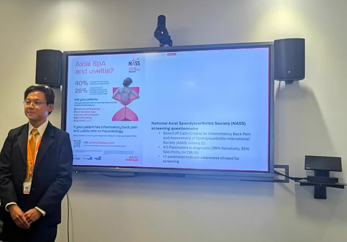 Timothy Boey, Liverpool University medical student who presented an audit on Axial SpA and Uveitis