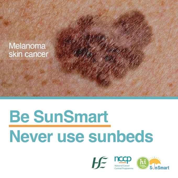 Melanoma skin cancer with the text 'Be SunSmart, never use sunbeds'. The HSE, National Cancer Control Programme and SunSmart logos are in the image. 