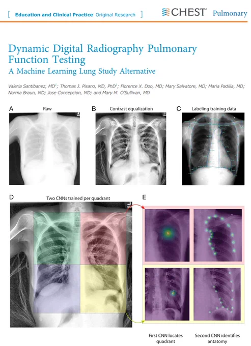 Link: 
https://www.chestpulmonary.org/article/S2949-7892(24)00018-7/fulltext

Image from article 'Dynamic Digital Radiography Pulmonary Function Testing: A Machine Learning Lung Study Alternative' showing the machine learning process.