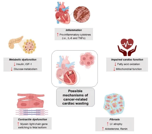 Possible mechanisms of cancer-related cardiac wasting.