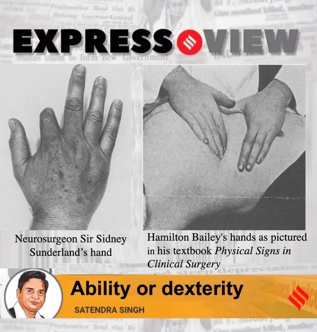 Photo showing neurosurgeon Sunderland’s amputated finger & Hamilton Bailey’s missing finger