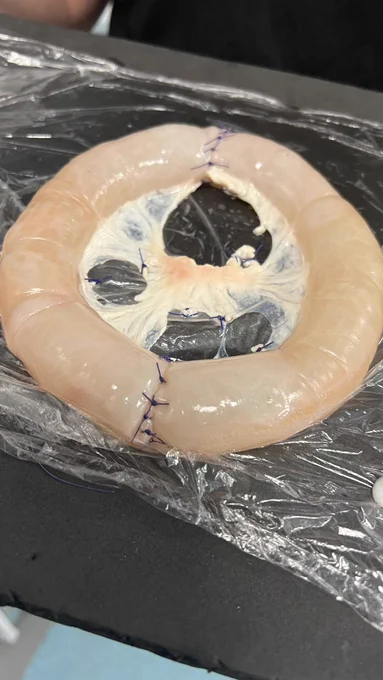 Partial pig bowl that has been sutured and filled with air.