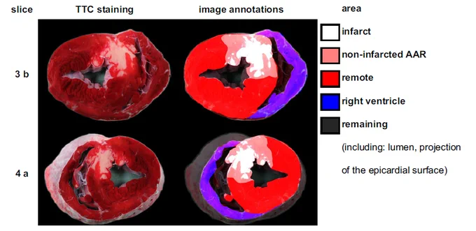Example of segmentation areas, showing two slices (the third slice in basal orientation and the fourth slice in apical orientation) from a representative experiment. AAR area at risk, TTC triphenyl tetrazolium
chloride.