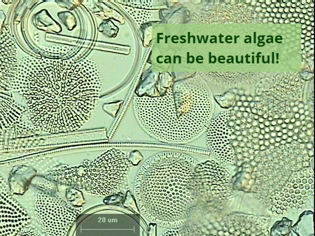 Algae under the microscope display a range of forms and geometric patterns that are stunning to behold!