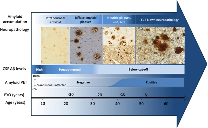 Figure from paper. Short caption: Lifelong accumulation of AD neuropathology in genetically determined forms of AD. Read the full paper for more information.