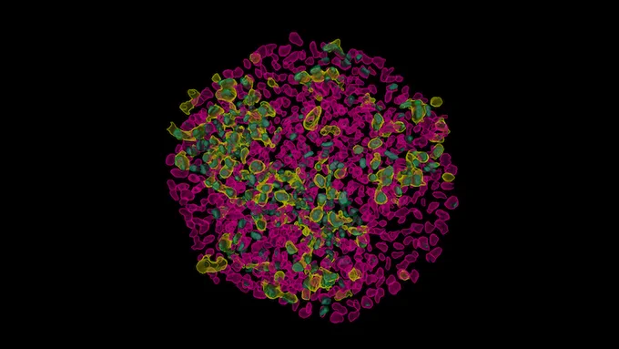 3D reconstruction of fluorescent signal in a 2D-gastruloid model from hESCs cultured on circular micropatterns. Cell nuclei (pink), SOX17 (turquoise), NANOS3 (yellow). Leica SP8 WL confocal (imaging), Zeiss Arivis Pro (3D reconstruction).
Image Theresa Gross-Thebing, Surani lab and Sargon Gross-Thebing, Imaging group.