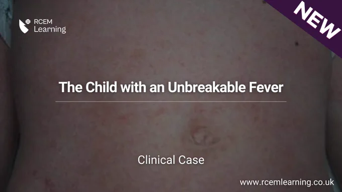 The Child with an Unbreakable Fever
Clinical Case
Which is the most likely diagnosis?
NEW - RCEMLearning