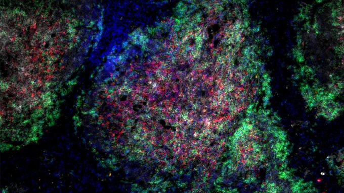Fluorescence image of T cells and B cells in the spleen. (Image: Winer Lab)