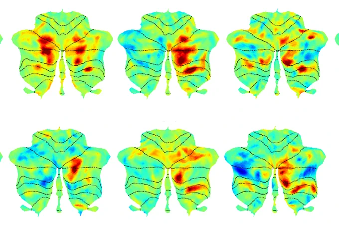 Six fMRI scans showing activity in the cerebellum during language tasks. 