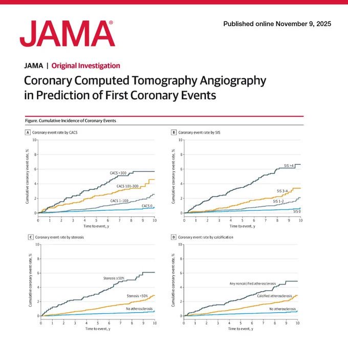 Graphs showing cumulative coronary event rates over time. Graph A: CACS>300 increases faster. Graph B: SIS>4  has a higher event rate. Graph C: Stenosis >=50% rises more sharply. Graph D: Any noncalcified atherosclerosis has higher rate.