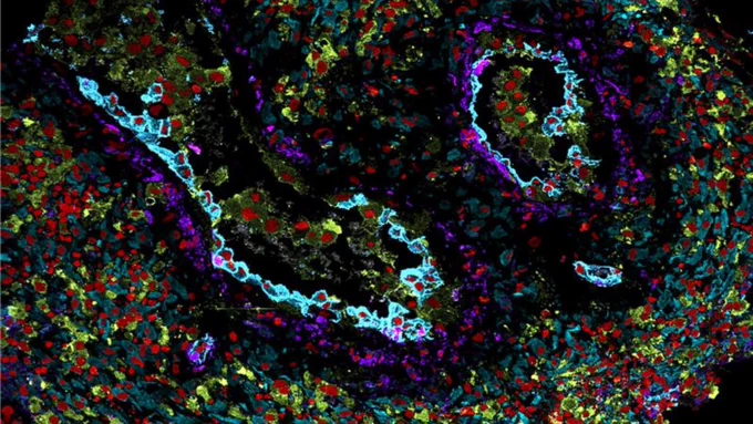 Image of the decidua, also captures fetal cells within and around maternal spiral arteries.