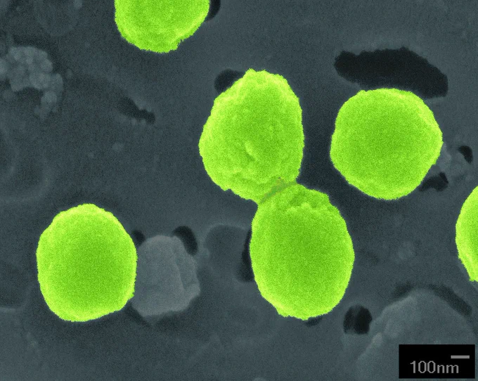 Large neon-green objects on gray background. Caption: A colorized scanning electronic microscopic image of Prochlorococcus, a beneficial organism whose functions can be compromised by viral infection. Image courtesy of Chisholm Lab/MIT via Creative Commons.
