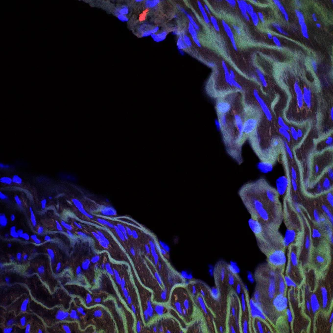 A confocal image of a wild-type aorta stained with human lamin A and lamin C (shown in green), Ang2 (in red) and the nucleus (in blue). Image courtesy of Sahar Vakili. 
