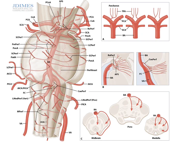 AICA, anterior inferior cerebellar artery; APS, anterior perforated substance;
ASA, anterior spinal artery; BA, basilar artery; CauPerf, caudal perforator; CoA, collicular artery; FC, foramen cecum; LCPerf, long circumflex perforator;
LMedPerf (Pica), lateral medullary perforator (PICA origin); LMedPerf (Vert), lateral medullary perforator (vertebral artery origin); MPerf, medullary
perforating artery; PadA, Padget arcade; PaPerf, paramedian perforator; PerfAnast, perforating arteries anastomoses; PCA, posterior cerebral artery;
PICA, posterior inferior cerebellar artery; PCoA, posterior communicating artery; PonA, pontine artery; RoPerf, rostral perforator; SCA, superior
cerebellar artery; SCPerf, short circumflex perforator; TPA, thalamoperforators; VA, vertebral artery.