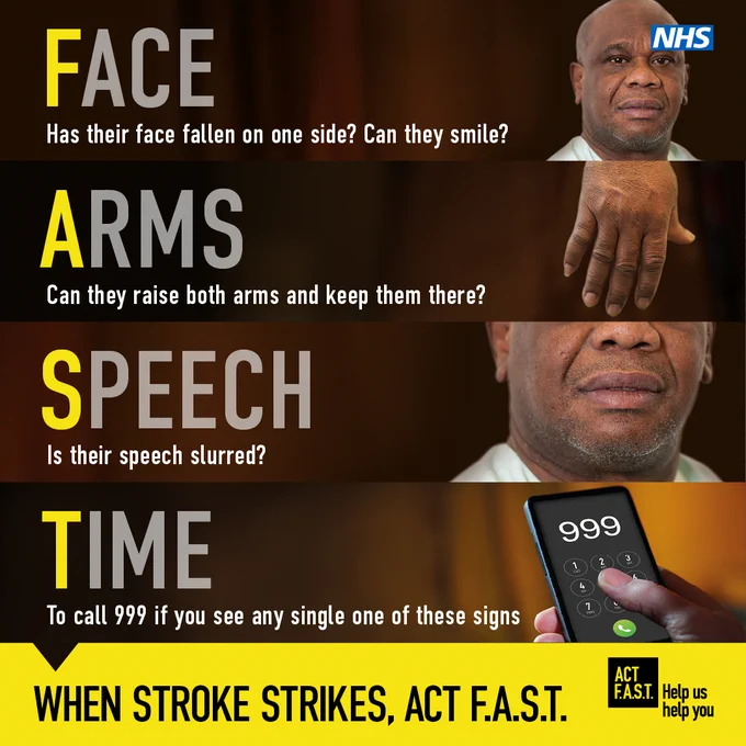 A series of images showing the symptoms of stroke.

Face: Has their face fallen on one side? Can they smile?

Arms: Can they raise both arms and keep them there?

Speech: Is their speech slurred?

Time: To call 999 if you see any single one of these signs.

When stroke strikes, act F.A.S.T.

The NHS logo is in the top right hand corner.