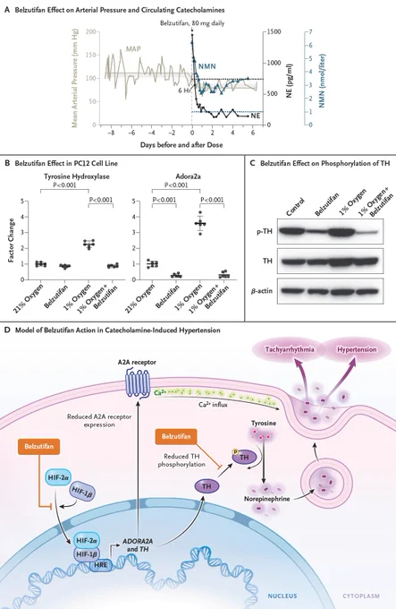 Panel A: Fluctuations in the mean arterial pressure (MAP), which normalized after the initiation of belzutifan. 
Panel B: The mechanisms behind the belzutifan effect in catecholamine-induced hypertension in a murine PC12 cell line. 
Panel C: The decrease in phosphorylation of tyrosine hydroxylase (p-TH) at serine 40, which suggests a reduction in hypoxia-stimulated activity. 
Panel D: A model for belzutifan action in catecholamine-induced hypertension, in which inhibition of HIF-2α–HIF-1β dimerization results in reduced expression of tyrosine hydroxylase. 