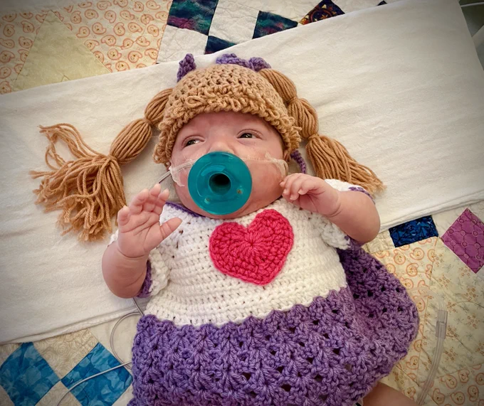 NICU baby dressed as Cabbage Patch Kid