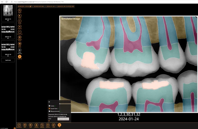 AI image of a dental x-ray