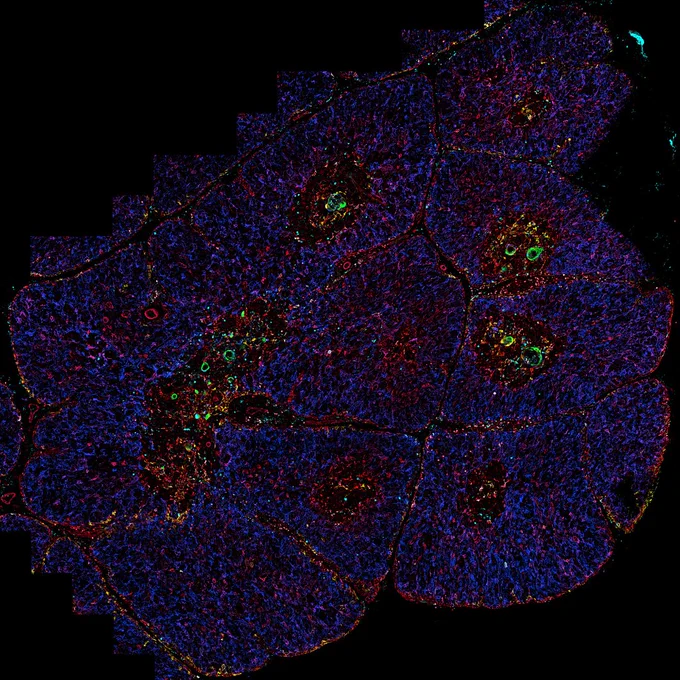 Image of human thymus, with epithelial cells labelled with different dyes to give different colours (blue, green yellow, red) Credit: Andrea Radtke / NIH.