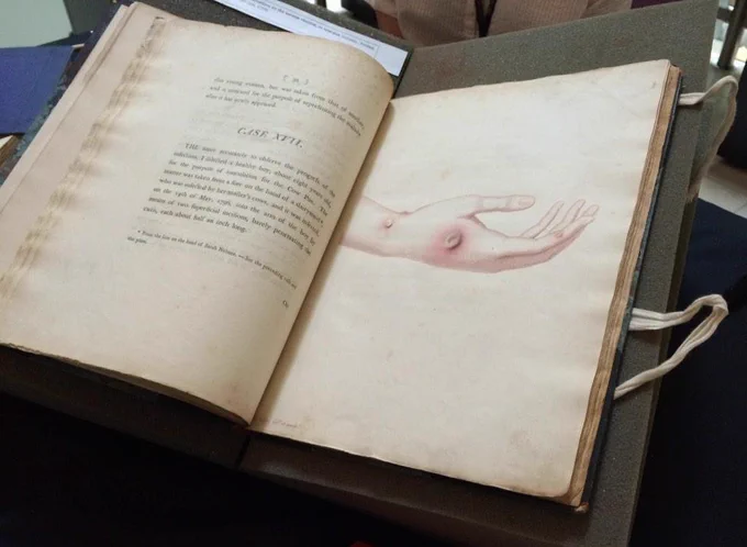 Photograph of a copy of 'An Inquiry into the Causes and Effects of the Variolae Vacciniae' by Edward Jenner, published 1798.
