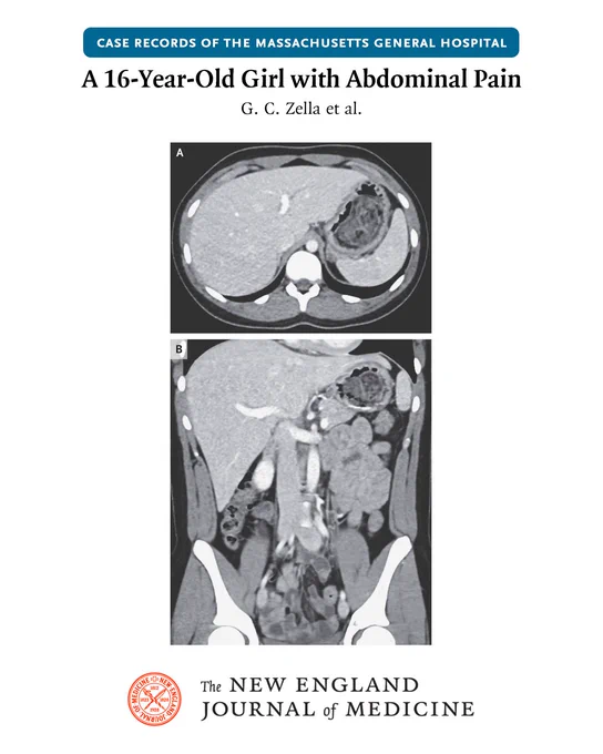 Case Records of the Massachusetts General Hospital
A 16-Year-Old Girl with Abdominal Pain
G. C. Zella et al.

CT of the Abdomen and Pelvis.

NEJM identity sits at the bottom.