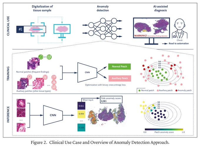 Figure 2. Clinical Use Case and Overview of Anomaly Detection Approach.