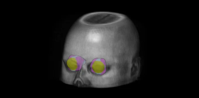 3D rendering of MRI eye atlas