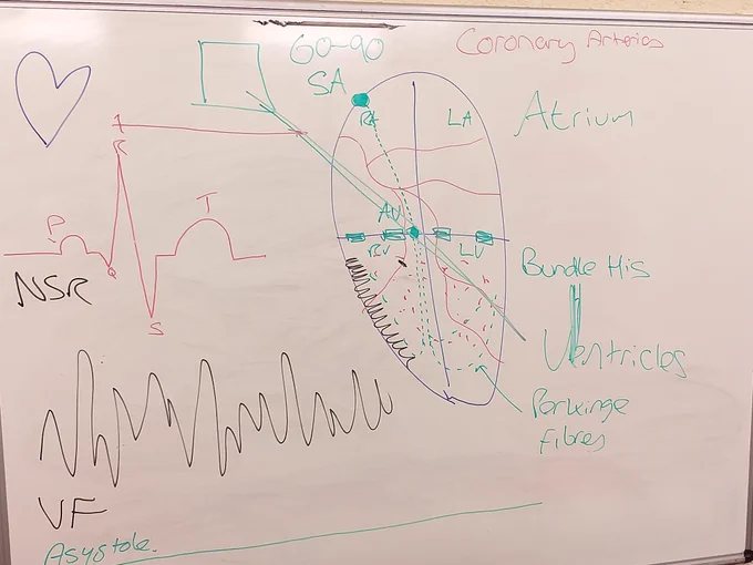 A diagram of the heart, showing heart rhythms and how a defibrillator sends the electrical current 