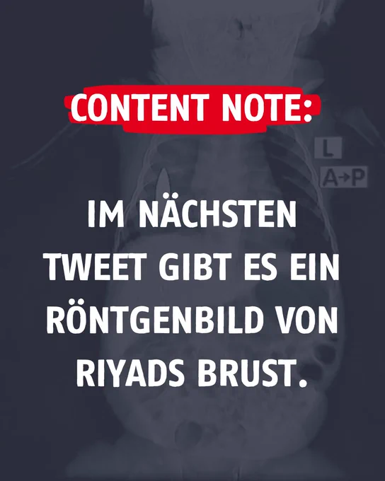 Das Bild ist eine Grafik, auf der steht: "Content Note: Im nächsten Tweet gibt es ein Röntgenbild von Riyads Brust."