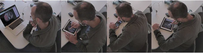 Four images show the same man from behind, who is wearing a green shirt. He sits at a desk and is using a laptop, iPad, iPhone, and iPad with stylus to contour on medical imaging screens.