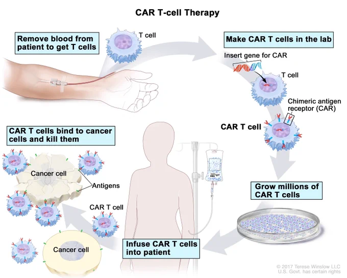 Source: NCI https://www.cancer.gov/publications/dictionaries/cancer-terms/def/car-t-cell-therapy