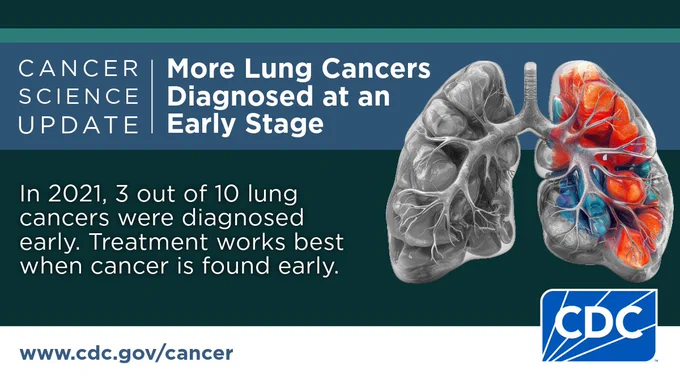 Illustration of a lung gray with red and blue highlighted areas. Text reads: “Cancer Science Update. More Lung Cancers Diagnosed at an Early Stage. In 2021, 3 out of 10 lung cancers were diagnosed early. Treatment works best when cancer is found early.” 
