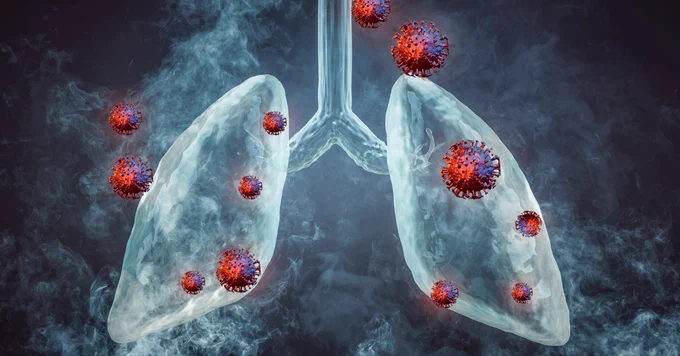 Image shows a pair of lungs surrounded by cancer cells.