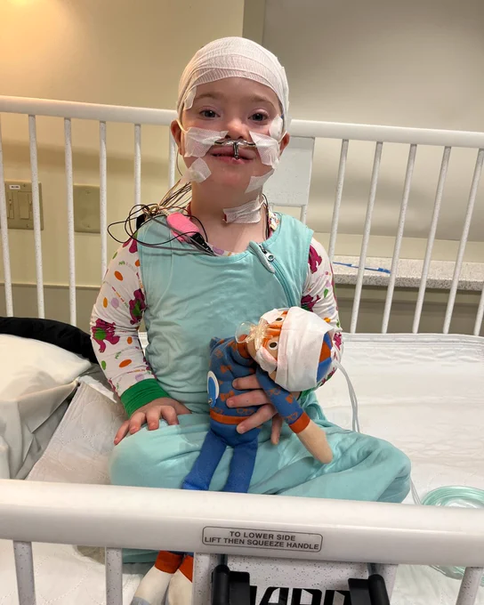 A child with bandages around their head and face, sitting in a hospital bed, holds a stuffed toy. Both the child and toy have similar bandages. Wires are attached to the child's face for medical monitoring.