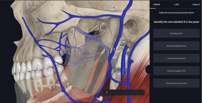 Anatomical image of a jaw. Text reads: identify the vein labelled X in the plate.