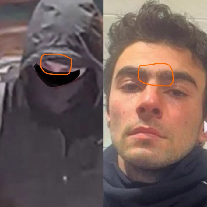 Image of two men’s nose bridges circled. One has very bushy eyebrows that almost join together, one has a large space of pale skin in between