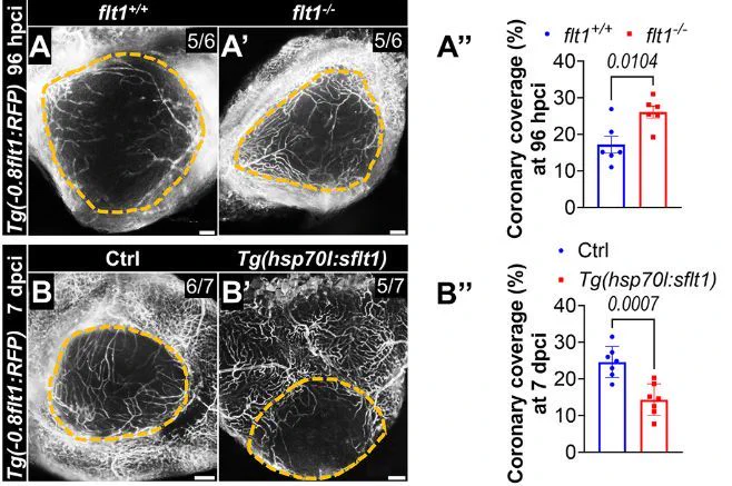 Figure 1 (A-B″) Whole-mount images of cryoinjured ventricles from Tg(-0.8flt1:RFP);flt1 /  (n=6, A) and Tg(-0.8flt1:RFP);flt1−/− (n=6, A′) zebrafish, and from Tg(-0.8flt1:RFP) (Ctrl, n=7, B) and Tg(-0.8flt1:RFP);Tg(hsp70l:sflt1) (n=7, B′) zebrafish showing revascularization of the injured area at 96 hpci (A,A′) and 7 dpci (B,B′), and the corresponding percentage of coronary coverage of the injured area (A″,B″)