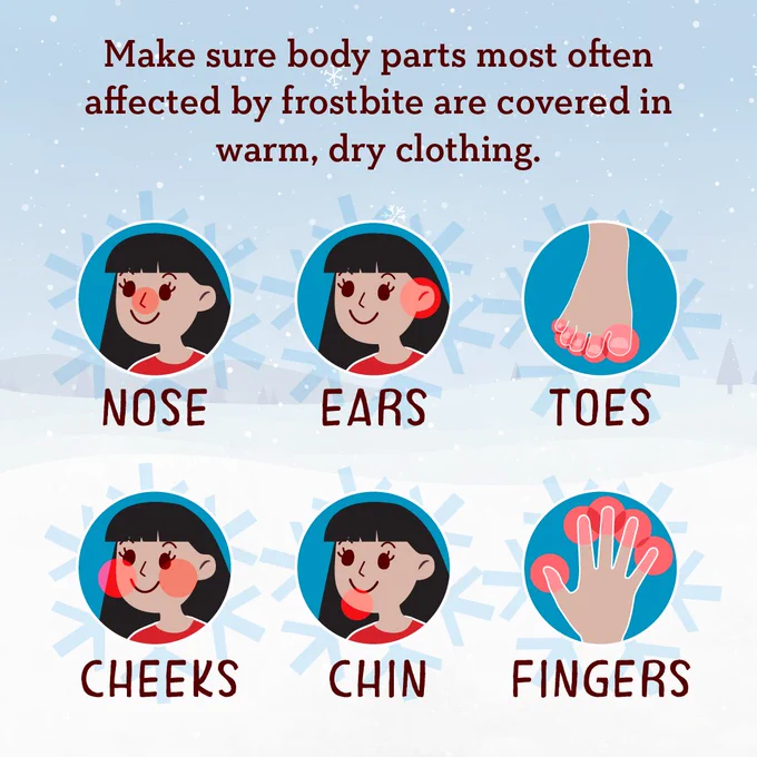 Infographic advising to cover the nose, ears, toes, cheeks, chin, and fingers to prevent frostbite in cold weather. Each body part is illustrated with a corresponding icon, highlighted against a snowy background.