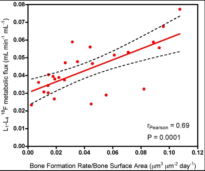 Aaltonen L, Koivuviita N, Seppänen M, Tong X, Kröger H, Löyttyniemi E, Metsärinne K. Correlation between 18F-Sodium Fluoride positron emission tomography and bone histomorphometry in dialysis patients. Bone. 2020 May;134:115267. doi: 10.1016/j.bone.2020.115267. Epub 2020 Feb 11. PMID: 32058018.
